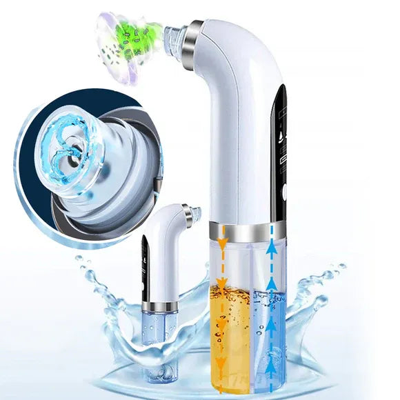 Bubble Facial & Blackhead Remover r