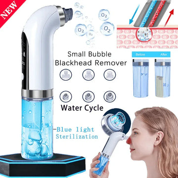 Bubble Facial & Blackhead Remover r